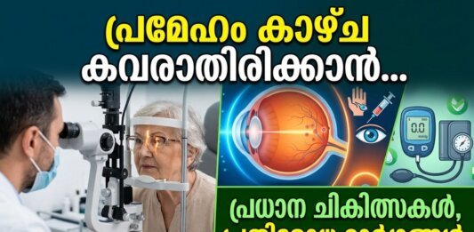 ഡയബറ്റിക് റെറ്റിനോപ്പതി ചികിത്സാ രീതികൾ വിശദീകരിക്കുന്ന ചിത്രം