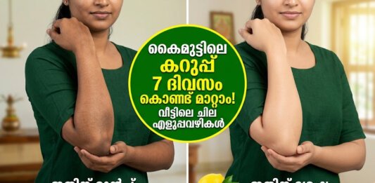 കൈമുട്ടിലെ കറുപ്പ് മാറാൻ കറ്റാർവാഴ ഉപയോഗിക്കുന്ന വിധം
