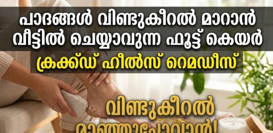 പാദങ്ങൾ വിണ്ടുകീറൽ മാറാൻ വീട്ടിൽ ചെയ്യാവുന്ന ഫൂട്ട് കെയർ